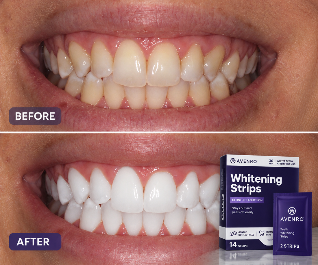 Purple Whitening Strips