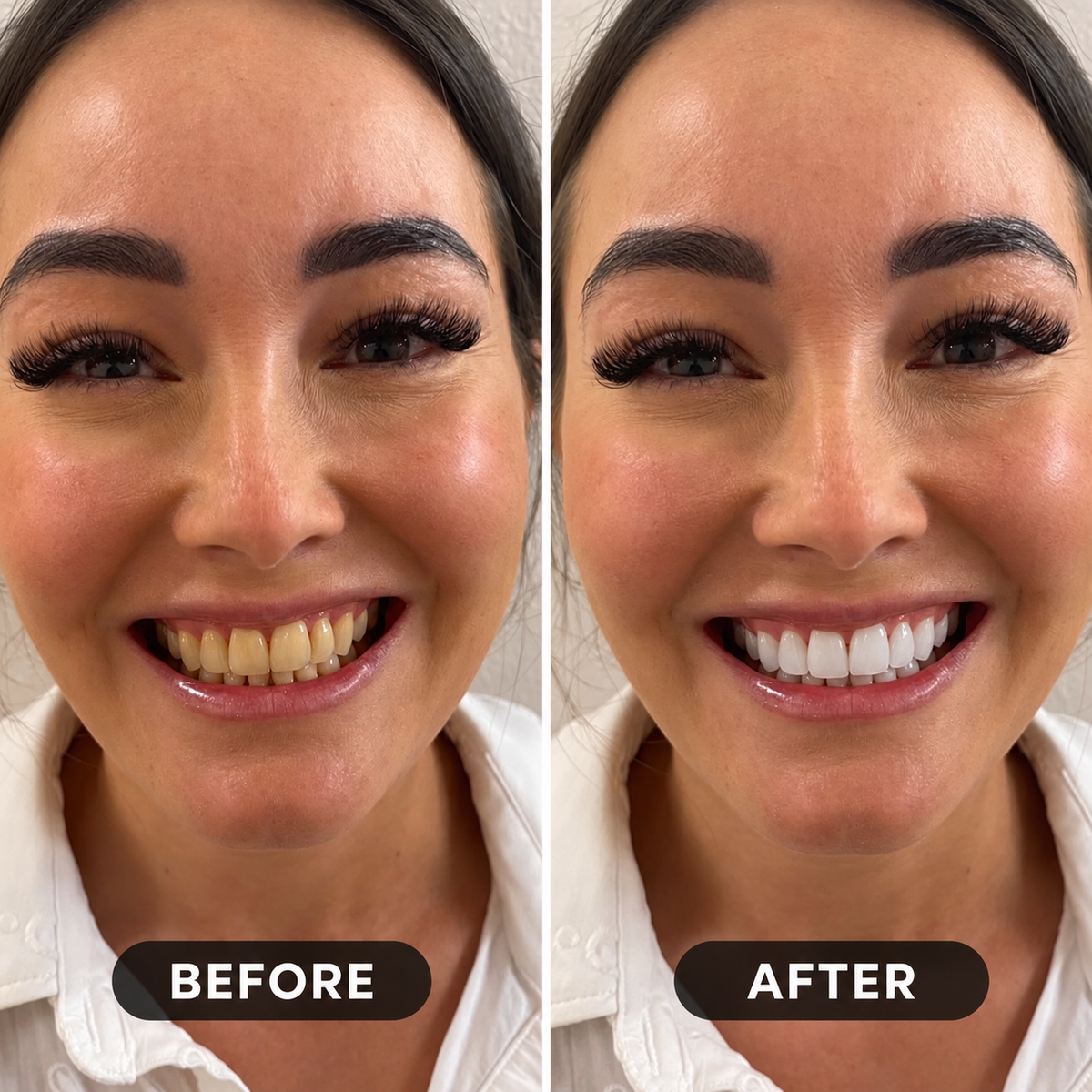 A BRIGHTER SMILE. A MORE CONFIDENT YOU.